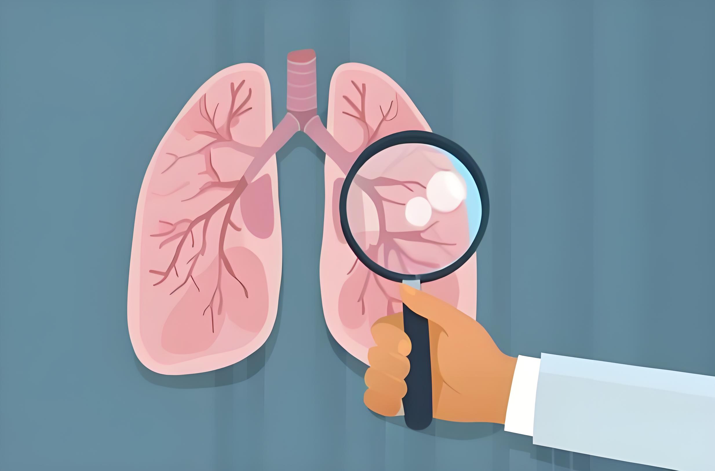 有结节，不纠结，三招教您辨“良恶”