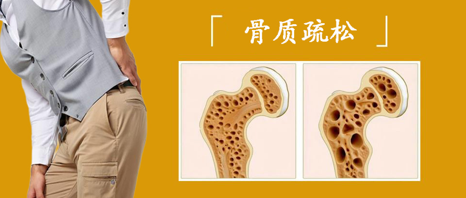 5种疼痛可能是骨质疏松的信号，很多人不知道