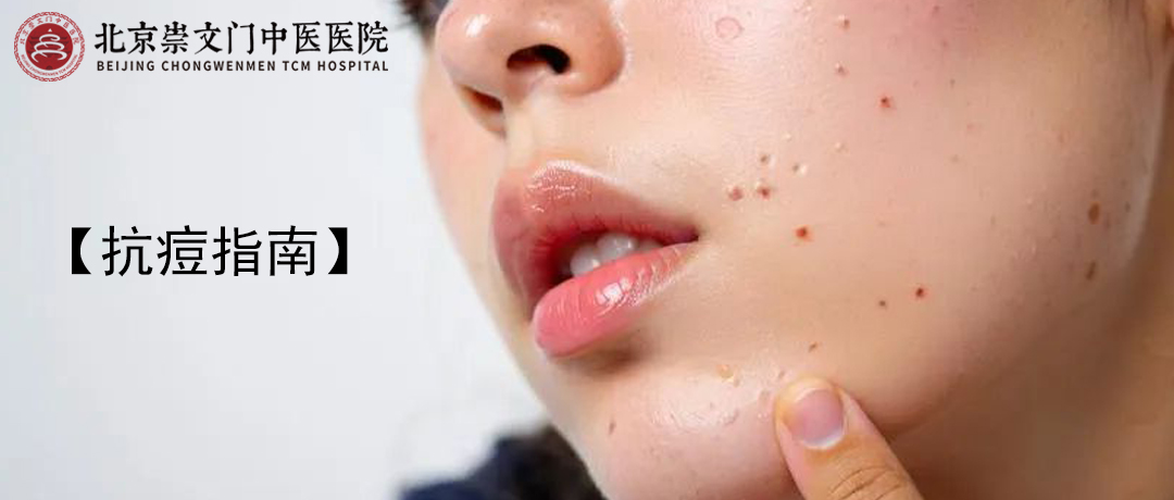 脸上反复长痘，多半与这4个原因有关，尽量避免!